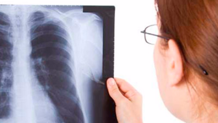 Відділення променевої діагностики (флюорографія) - Лікар-рентгенолог